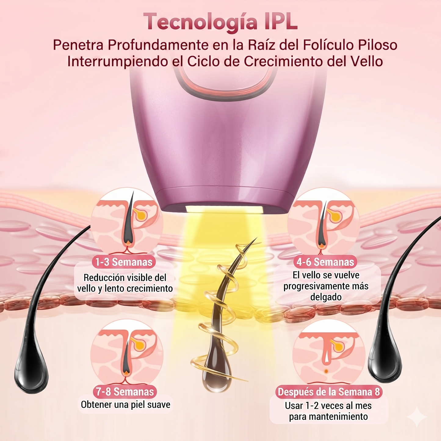 Depiladora láser IPL